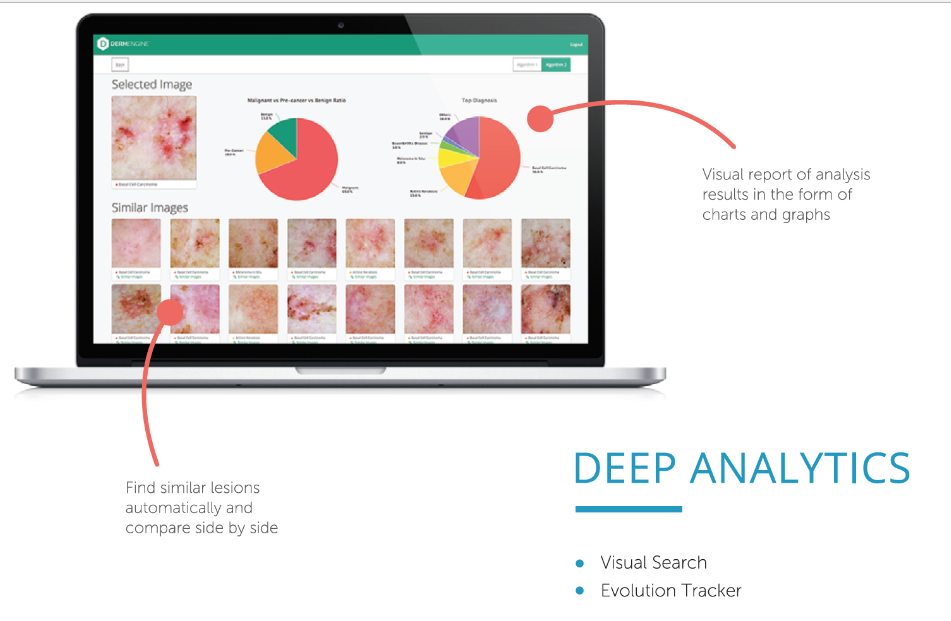 Artificial Intelligence (AI) In Dermatology: What Are The Advantages?